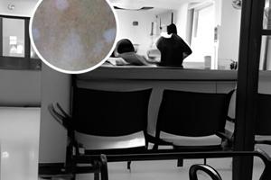 西安仁愛白癜風醫院是采用激光治療的嗎